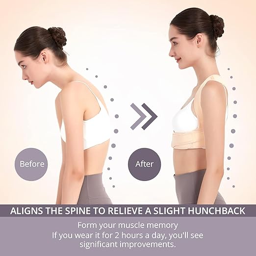 JMPOSE Posture Corrector for Back Support: Adjustable Shoulder Posture Brace for Men and Women (Beige, Large/X-Large)