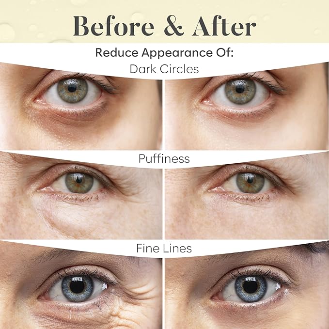 AURAE 24K Gold Under Eye Patches (30 Pairs) - Eye Mask for Dark Circles, Puffiness & Wrinkles - Hydrating Treatment for a Revitalized Look