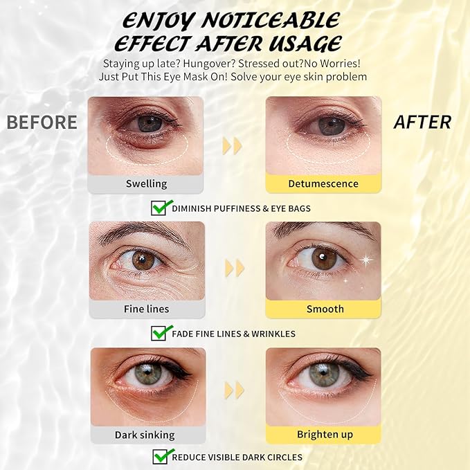 Maskiss Under Eye Patches(50 Pairs), 24K Gold, Caffeine, Hyaluronic Acid, Aloe Vera Eye Masks for Dark Circles Puffy Eyes Undereye Bags, Eye Skin Care Gift Set for Bachelorette Party Favors
